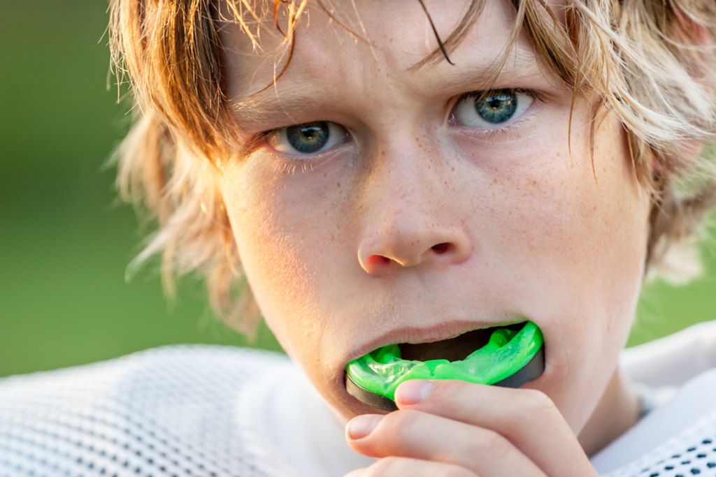 Mouth Guards in Ambleside Near Windermere
