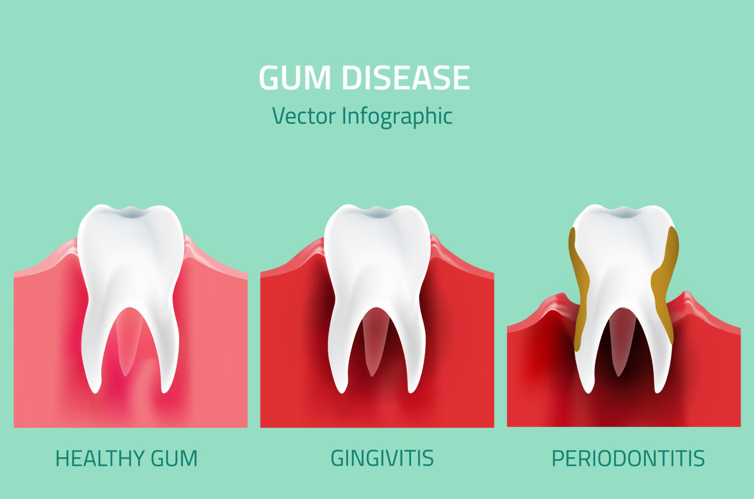 Periodontics in Ambleside Near Windermere