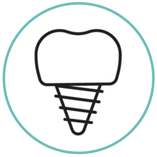 Dental Implants In Southwest Edmonton Smart Dental Art