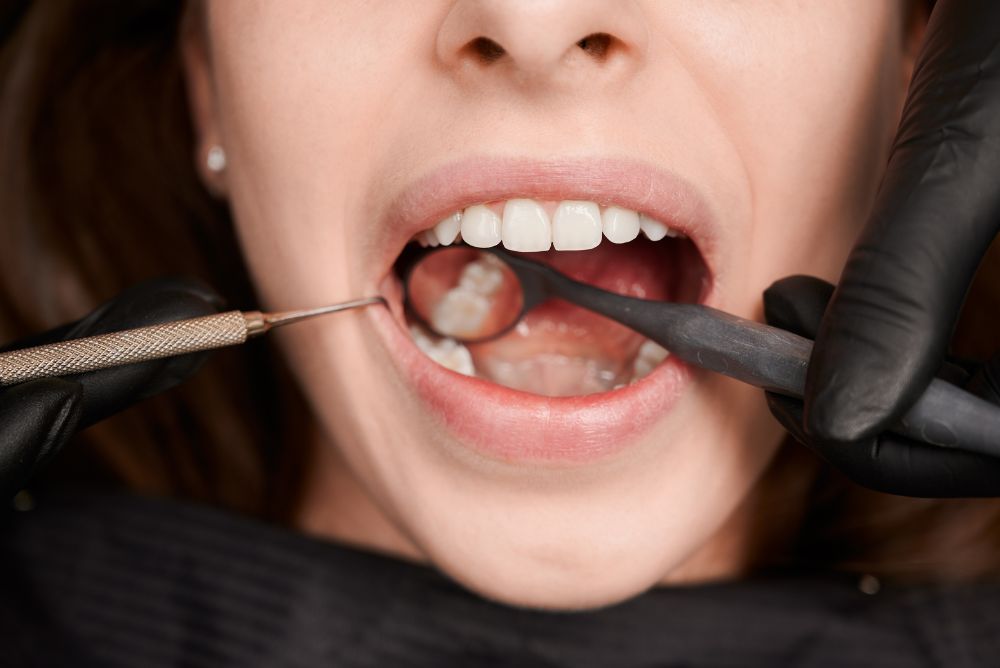 dental fillings in ambleside