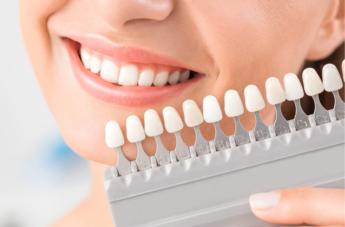 veneers for uneven front teeth